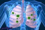 کلسترول خوب خطر ذات الریه و التهاب روده را زیاد کردن می دهد